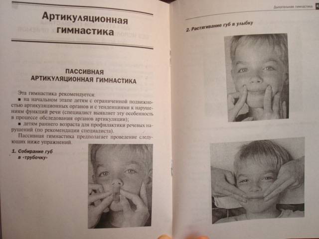 Дизартрия массаж упражнения Дизартрия массаж упражнения