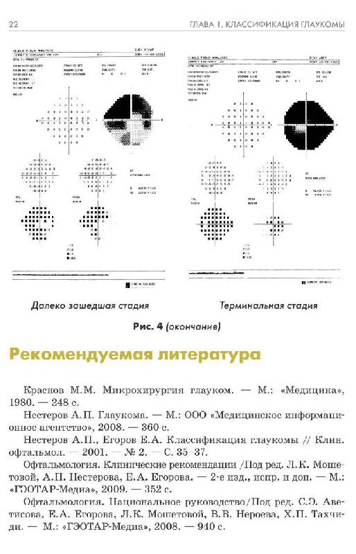 Рецензия покупателя на "Глаукома. Национальное руководство" - Издательство Альфа-книга