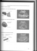 Ультразвуковое исследование иллюстрированное руководство джейн олти эдвард хойт