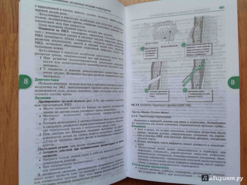 анестезиология под редакцией райнера шефера анестезиология под редакцией райнера шефера