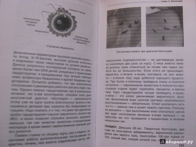 Купить книгу гирудотерапия руководство по лечению медицинскими пиявками