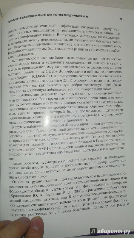 Иллюстрация 3 из 7 для Псевдолимфомы кожи - Олисова, Потекаев | Лабиринт - книги. Источник: Савчук Ирина