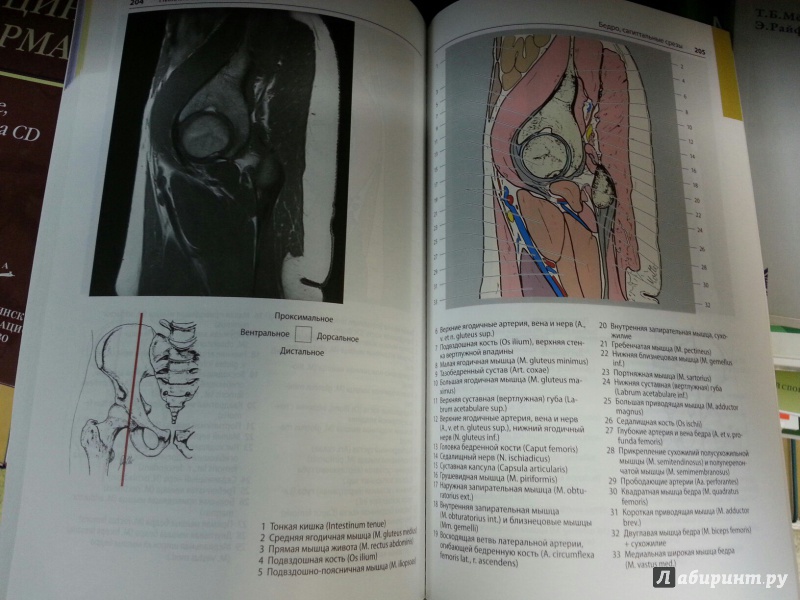 Иллюстрация 8 из 12 для Атлас секционной анатомии человека на примере КТ- и МРТ-срезов. Том 3. Позвоночник, конечности - Меллер, Райф | Лабиринт - книги. Источник: Den