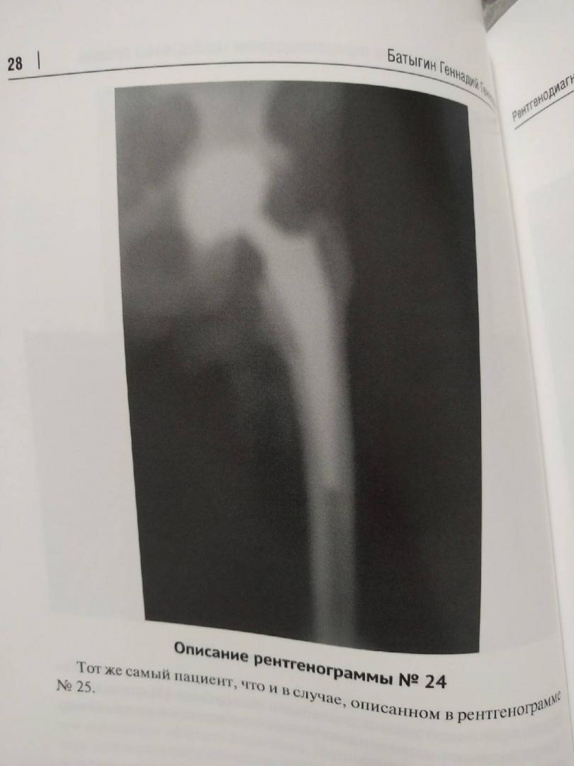Иллюстрация 3 из 7 для Рентгенологический регистр по эндопротезированию тазобедренных суставов - Геннадий Батыгин | Лабиринт - книги. Источник: Doc_radiology