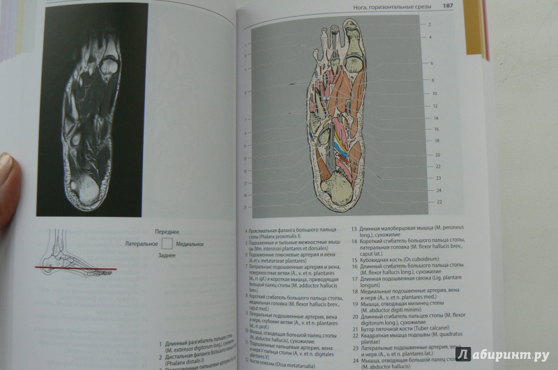 Иллюстрация 4 из 12 для Атлас секционной анатомии человека на примере КТ- и МРТ-срезов. Том 3. Позвоночник, конечности - Меллер, Райф | Лабиринт - книги. Источник: Марина