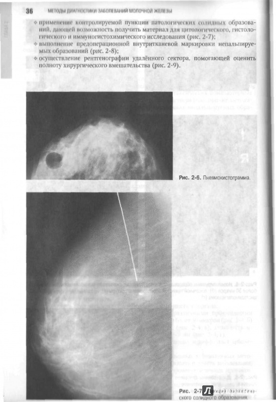 Иллюстрация 21 из 55 для Маммология. Национальное руководство (+ CD) - Рожкова, Харченко | Лабиринт - книги. Источник: Мягков  Александр