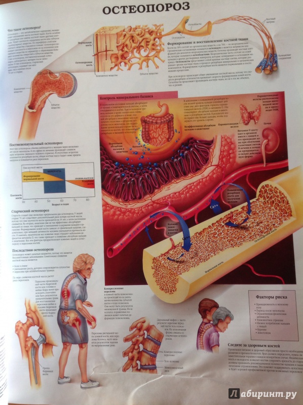 Иллюстрация 3 из 6 для Анатомия человека. Болезни и нарушения | Лабиринт - книги. Источник: katyleb