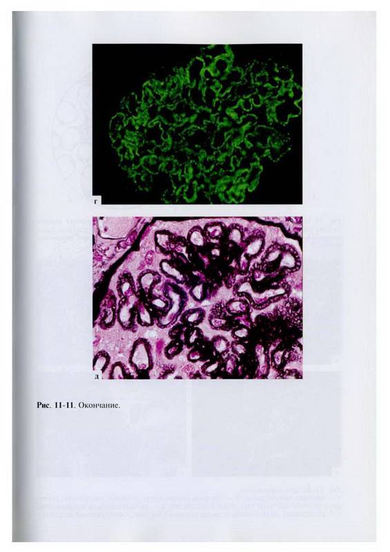 Иллюстрация 5 из 8 для Нефрология (+CD) | Лабиринт - книги. Источник: Ялина