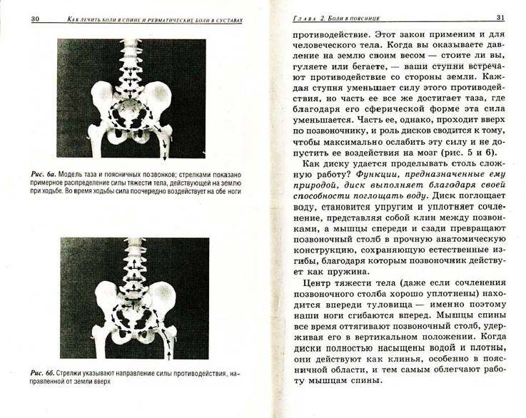 Иллюстрация 13 из 34 для Как лечить боли в спине и ревматические боли в суставах - Ферейдон Батмангхелидж | Лабиринт - книги. Источник: alexss
