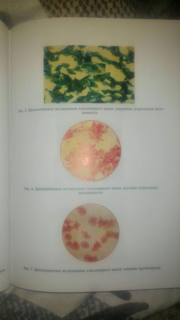 Иллюстрация 25 из 26 для Гинекология - Айламазян, Яковлев, Рябцева | Лабиринт - книги. Источник: Панферова Вероника