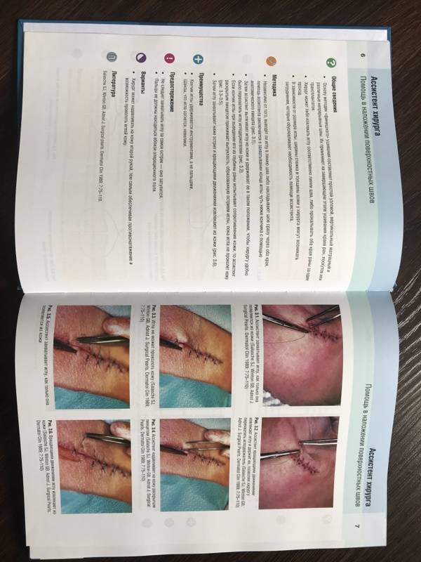 Иллюстрация 4 из 7 для Дерматохирургия. Know-How для косметологов и дерматологов - Сейласке, Оренго, Сигл | Лабиринт - книги. Источник: Попандопуло  Елена