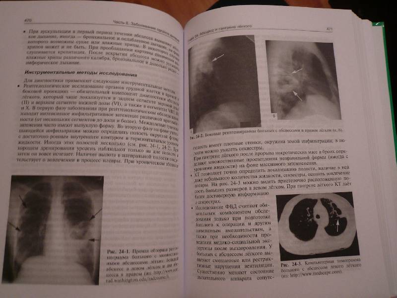 Иллюстрация 15 из 31 для Внутренние болезни. Учебник. В 2-х т. Том 2  (+CD) | Лабиринт - книги. Источник: marsopit