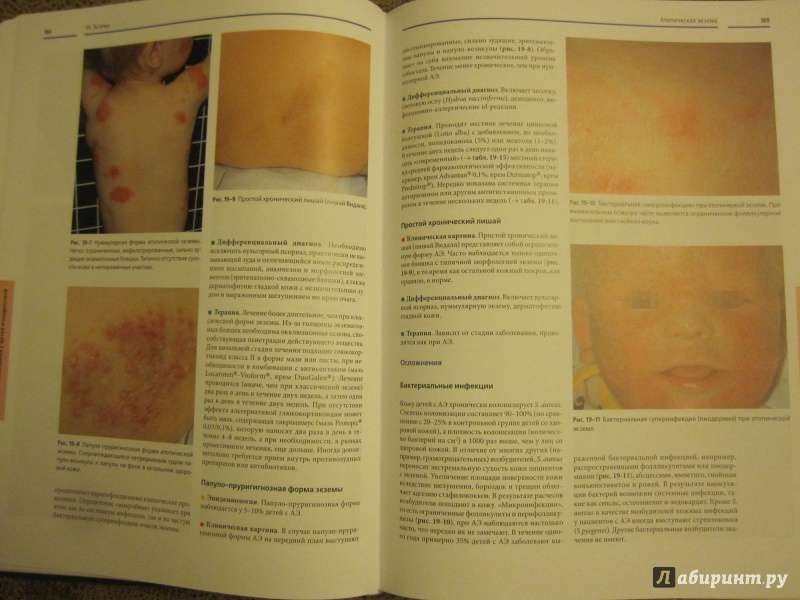 Иллюстрация 5 из 10 для Детская дерматология - Петер Хегер | Лабиринт - книги. Источник: Юлия