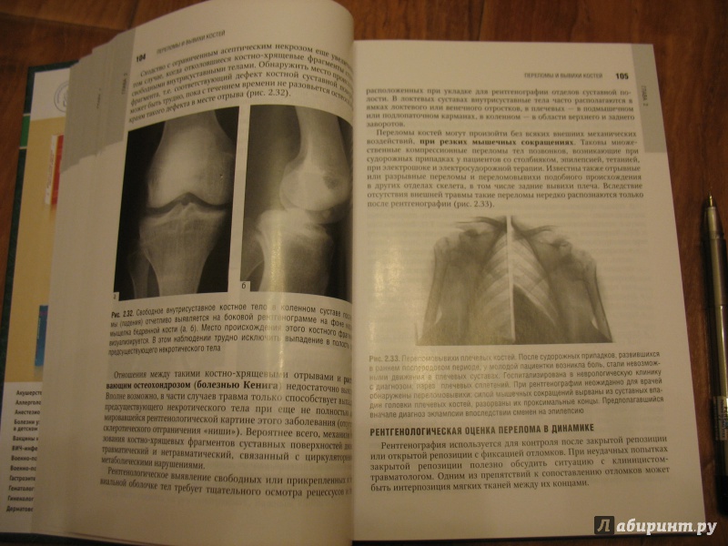 Иллюстрация 4 из 11 для Лучевая диагностика заболеваний костей и суставов. Национальное руководство | Лабиринт - книги. Источник: Крелена