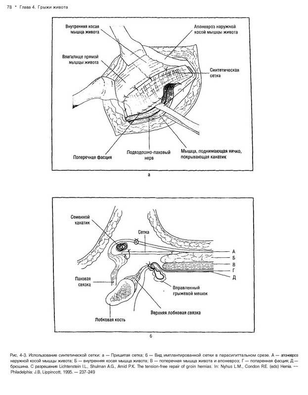Иллюстрация 7 из 10 для Общая и неотложная хирургия | Лабиринт - книги. Источник: Ялина