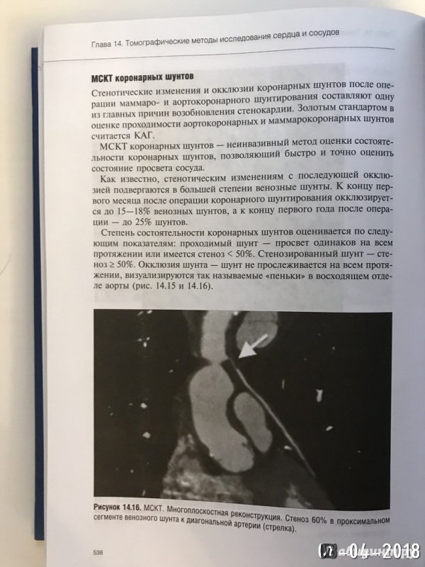 Иллюстрация 27 из 29 для Руководство по кардиологии. Том 2. Методы диагностики сердечно-сосудистых заболеваний | Лабиринт - книги. Источник: Ромыдтчъ