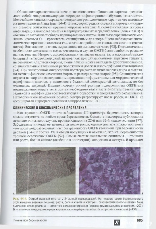 Иллюстрация 5 из 28 для Введение в гепатологию - Шифф, Соррел, Мэддрей | Лабиринт - книги. Источник: ВраЧиталла