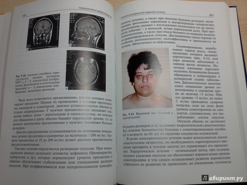 Иллюстрация 4 из 34 для Неврология и нейрохирургия. Учебник. В 2-х томах. Том 2 - Коновалов, Гусев, Скворцова | Лабиринт - книги. Источник: tyk-marina