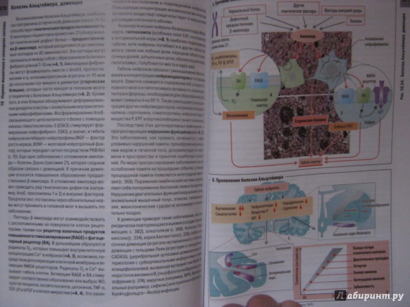 Иллюстрация 20 из 33 для Клиническая патофизиология. Атлас - Зилбернагль, Ланг | Лабиринт - книги. Источник: Евгения39