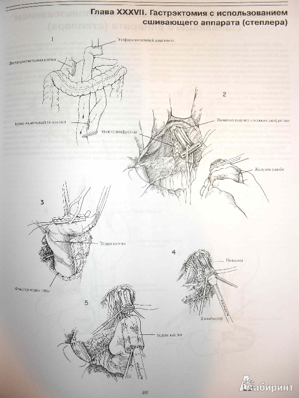 Иллюстрация 4 из 19 для Атлас хирургических операций - Золлингер, Золлингер | Лабиринт - книги. Источник: ВраЧиталла