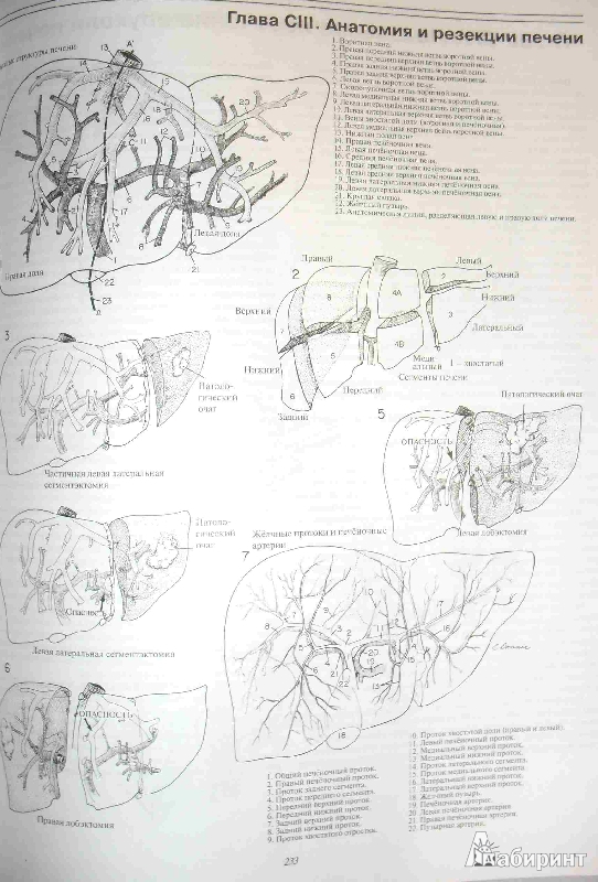 Иллюстрация 8 из 19 для Атлас хирургических операций - Золлингер, Золлингер | Лабиринт - книги. Источник: ВраЧиталла