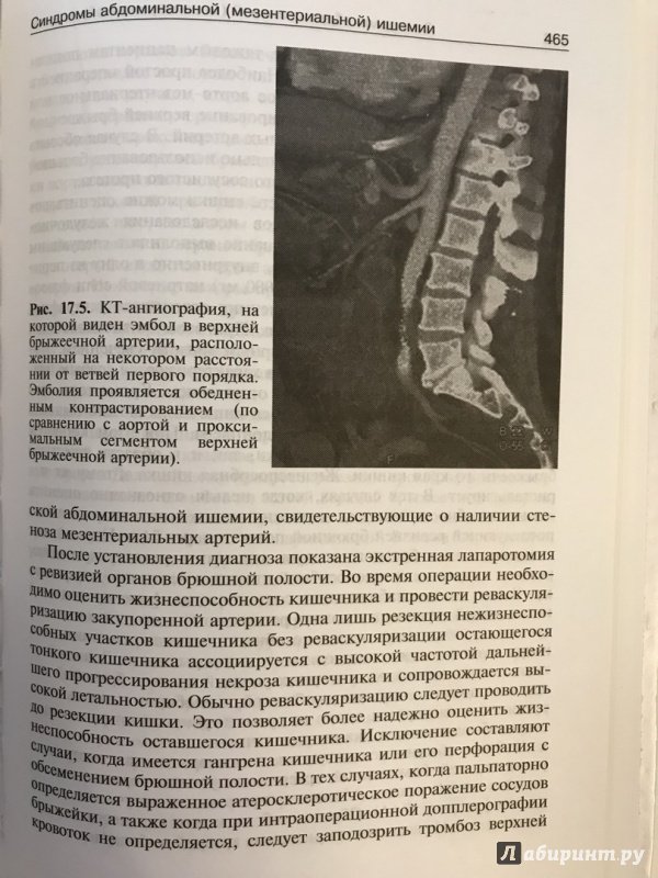 Иллюстрация 26 из 26 для Руководство по ангиологии и флебологии - Расмуссен, Клауз, Тоннессен | Лабиринт - книги. Источник: Ромыдтчъ