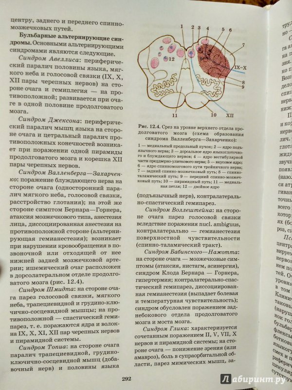 Иллюстрация 45 из 49 для Топическая диагностика заболеваний нервной системы. Руководство для врачей - Скоромец, Скоромец, Скоромец | Лабиринт - книги. Источник: Пилюк  Мария