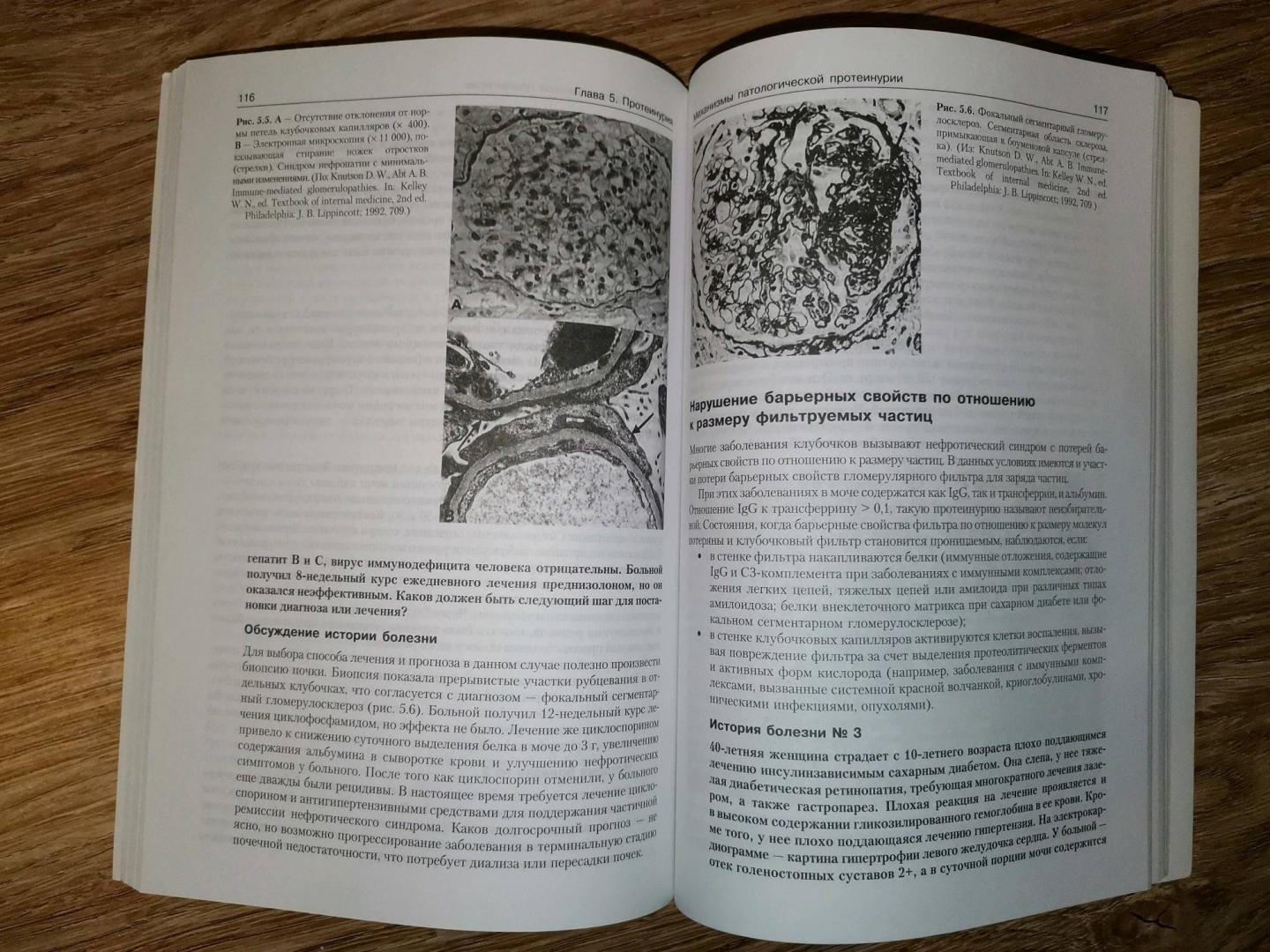Иллюстрация 18 из 24 для Патофизиология почки - Джеймс Шейман | Лабиринт - книги. Источник: Snow 71