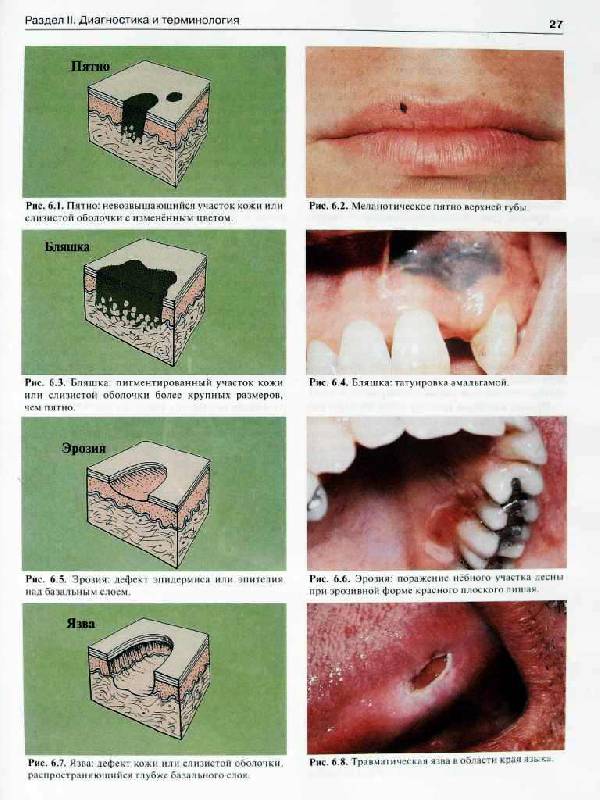 Иллюстрация 15 из 18 для Атлас заболеваний полости рта: Атлас - Лангле, Миллер | Лабиринт - книги. Источник: Юта