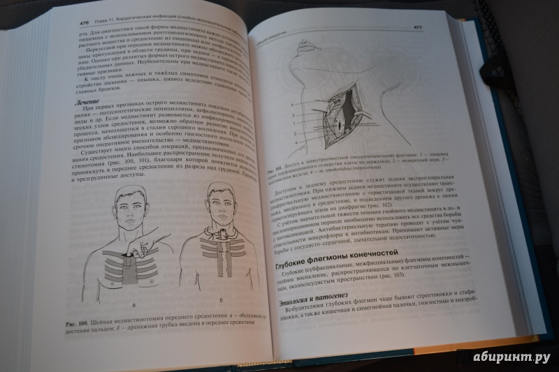 Иллюстрация 7 из 28 для Общая хирургия. Учебник - Виктор Гостищев | Лабиринт - книги. Источник: ВраЧиталла