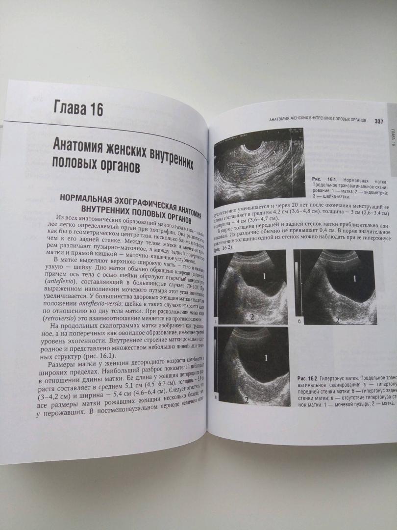 Иллюстрация 23 из 29 для Лучевая диагностика и терапия в акушерстве и гинекологии - Адамян, Гус, Демидов, Обельчак | Лабиринт - книги. Источник: Лабиринт