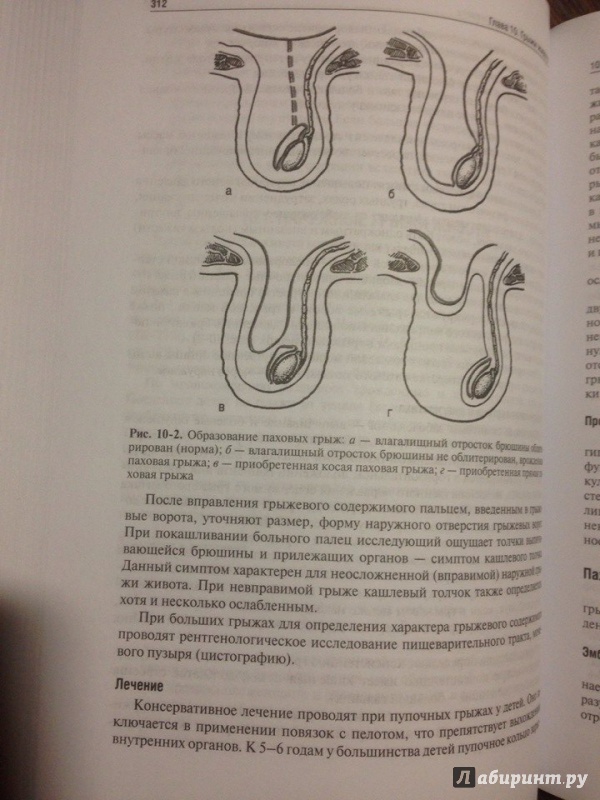 Иллюстрация 7 из 62 для Хирургические болезни. Учебник - Ветшев, Кузин, Касян | Лабиринт - книги. Источник: ВраЧиталла