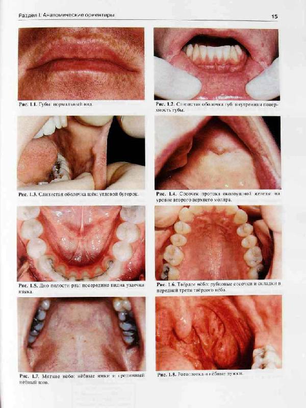 Иллюстрация 7 из 18 для Атлас заболеваний полости рта: Атлас - Лангле, Миллер | Лабиринт - книги. Источник: Юта