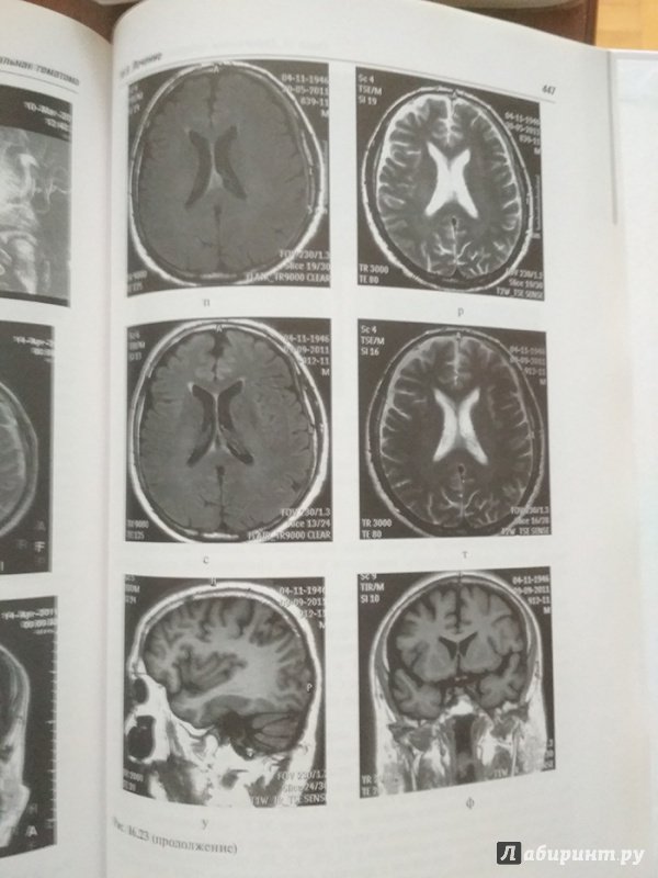 Иллюстрация 8 из 32 для Черепно-мозговая травма. Диагностика и лечение - Леонид Лихтерман | Лабиринт - книги. Источник: Кsena