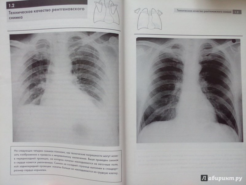 Иллюстрация 5 из 11 для Рентгенография грудной клетки - Корн, Пойнтон | Лабиринт - книги. Источник: Савостин  Александр