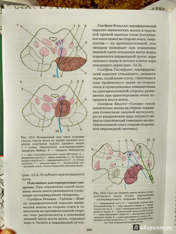Иллюстрация 43 из 49 для Топическая диагностика заболеваний нервной системы. Руководство для врачей - Скоромец, Скоромец, Скоромец | Лабиринт - книги. Источник: Пилюк  Мария