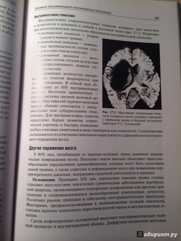 Иллюстрация 18 из 18 для Патологическая анатомия. Учебник. В 2-х томах. Том 2. Частная патология - Пауков, Пономарев, Федоров | Лабиринт - книги. Источник: | favouritevampire |