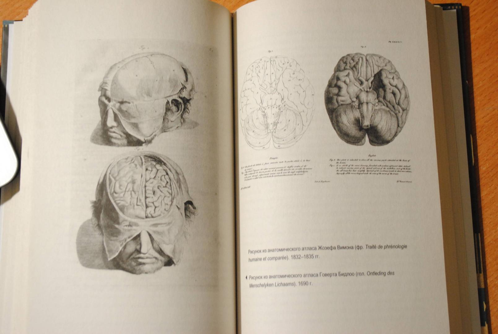 Иллюстрация 42 из 46 для Мозг. Тайны разума - Уайлдер Пенфилд | Лабиринт - книги. Источник: Бачкалов Егор