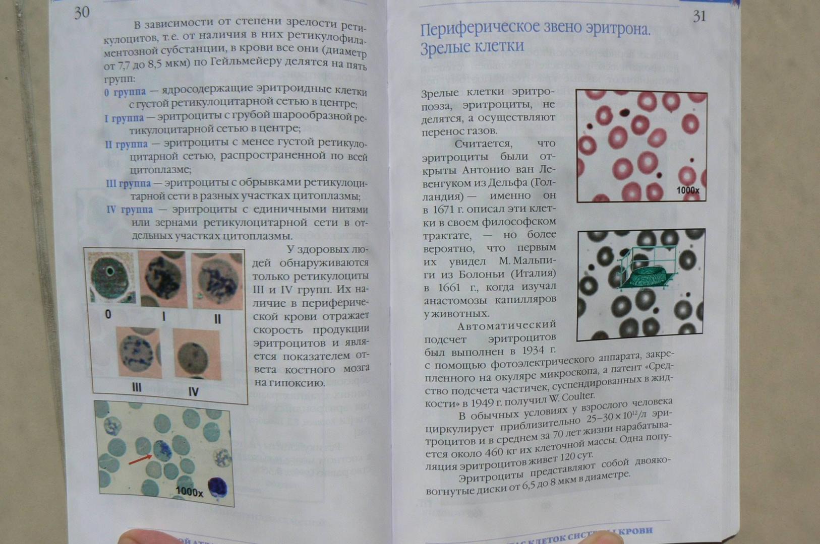 Иллюстрация 12 из 16 для Цветной атлас клеток системы крови - Погорелов, Проценко, Козинец | Лабиринт - книги. Источник: Лидия