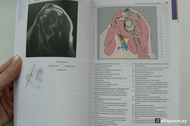 Иллюстрация 3 из 12 для Атлас секционной анатомии человека на примере КТ- и МРТ-срезов. Том 3. Позвоночник, конечности - Меллер, Райф | Лабиринт - книги. Источник: Марина