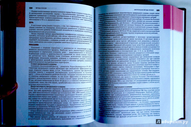 Иллюстрация 39 из 50 для Кардиология. Национальное руководство (+CD) | Лабиринт - книги. Источник: sakedas