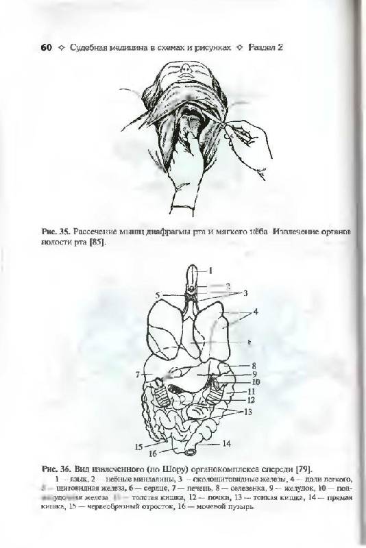 Иллюстрация 15 из 16 для Судебная медицина в схемах и рисунках - Пашинян, Ромодановский | Лабиринт - книги. Источник: Юта