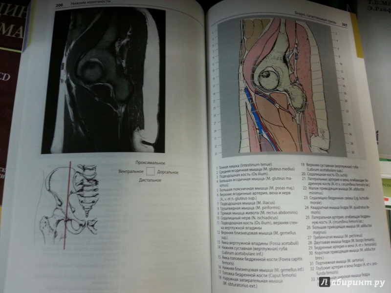 Иллюстрация 9 из 12 для Атлас секционной анатомии человека на примере КТ- и МРТ-срезов. Том 3. Позвоночник, конечности - Меллер, Райф | Лабиринт - книги. Источник: Den