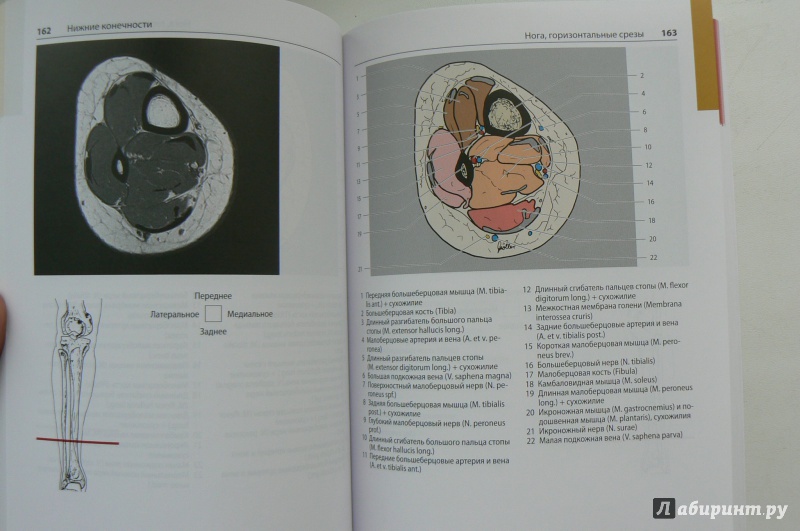 Иллюстрация 7 из 12 для Атлас секционной анатомии человека на примере КТ- и МРТ-срезов. Том 3. Позвоночник, конечности - Меллер, Райф | Лабиринт - книги. Источник: Марина