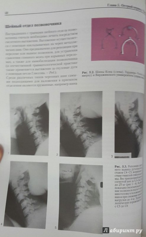 Иллюстрация 4 из 5 для Травма спинного мозга - Гранди, Суэйн | Лабиринт - книги. Источник: Den