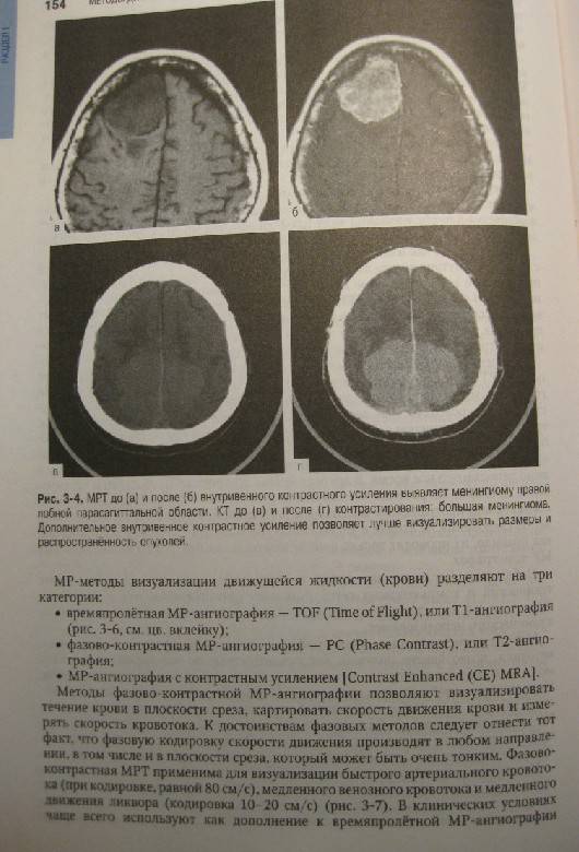 Иллюстрация 55 из 55 для Неврология: национальное руководство (+CD) | Лабиринт - книги. Источник: Неравнодушная