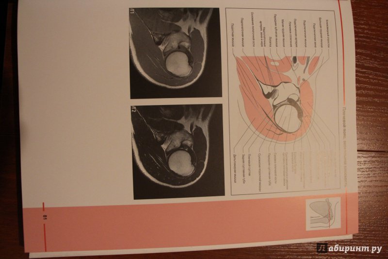 Иллюстрация 12 из 15 для МРТ костно-мышечной системы. Атлас - Роен, Лютьен-Дреколл, Хойк, Стайнборн | Лабиринт - книги. Источник: Книжные коллекции
