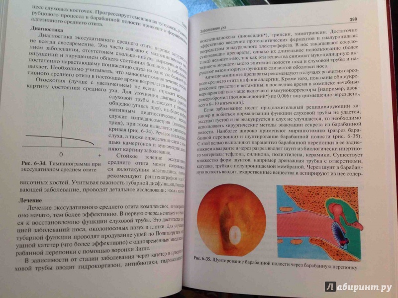 Иллюстрация 9 из 42 для Оториноларингология. Учебник - Пальчун, Лучихин, Магомедов | Лабиринт - книги. Источник: ВраЧиталла