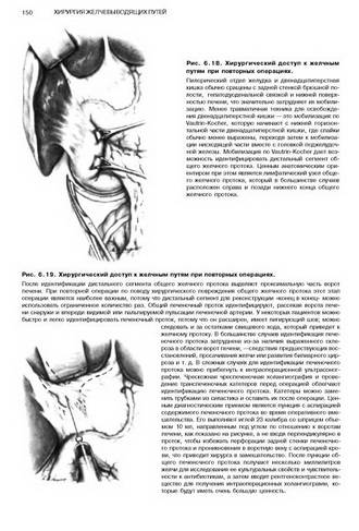 Иллюстрация 15 из 44 для Атлас абдоминальной хирургии. Том 1. Хирургия печени, желчных путей, поджелудочной железы - Эмилио Итала | Лабиринт - книги. Источник: Nadezhda_S