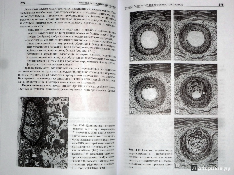 Иллюстрация 10 из 37 для Патологическая анатомия. Учебник - Струков, Серов | Лабиринт - книги. Источник: Лабиринт